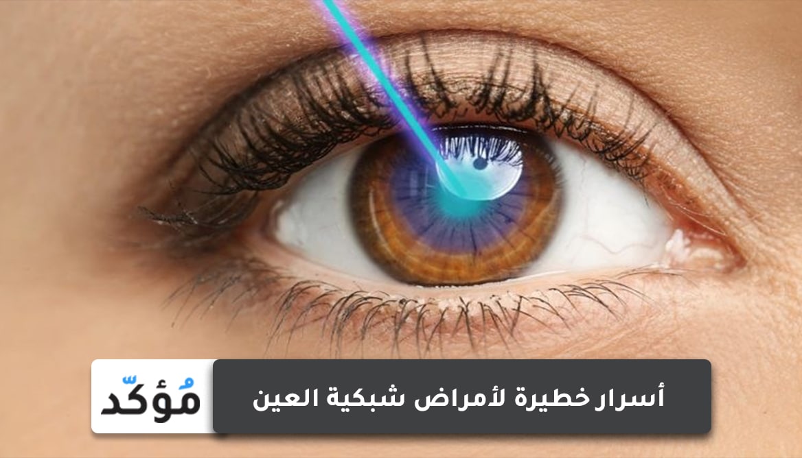 أسرار خطيرة لأمراض شبكية العين